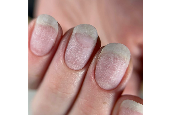 ناخنکده پروین رفیعی